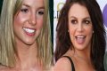 What’s Up with Britney Spears’ Smile? The Scoop on Her Noticeable Gap Teeth